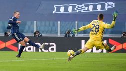 Juventus-Bologna, ecco l’MVP