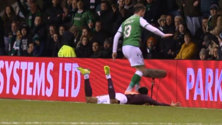Calpesta la schiena di un avversario nel derby di Edimburgo: l’arbitro non lo vede, ma arriva la squalifica pesante