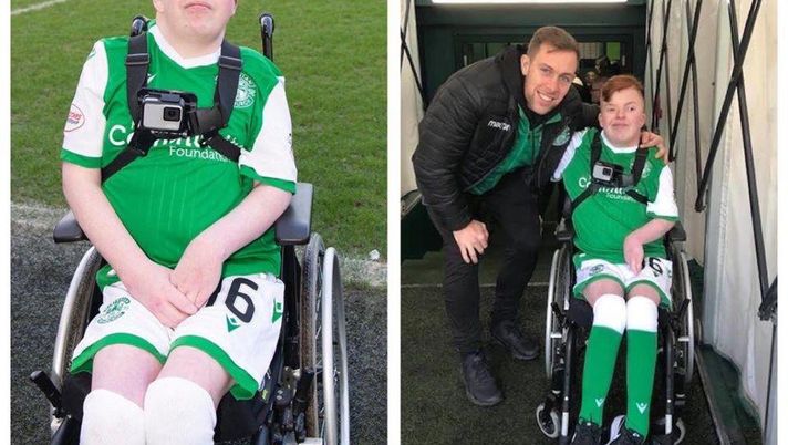 Darren, 23 anni e il 3% di possibilità di sopravvivere: ma la gioia di fare la mascotte per l’Hibernian è stata grande